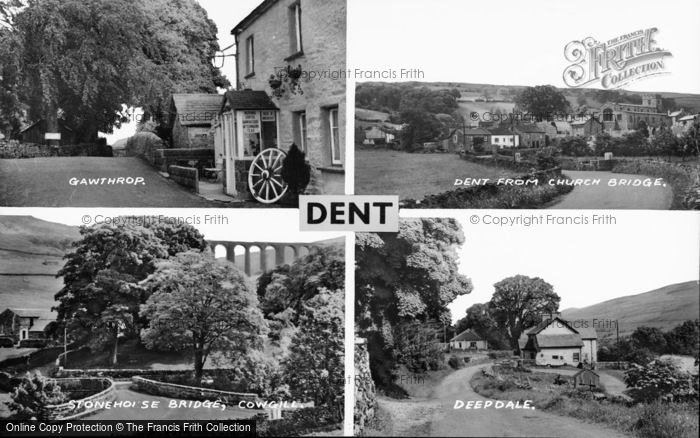 Photo of Dent, Composite c.1950