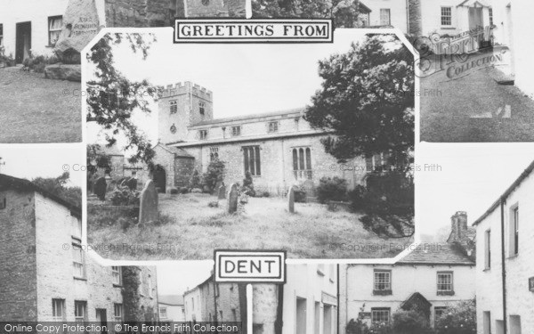 Photo of Dent, Composite c.1960